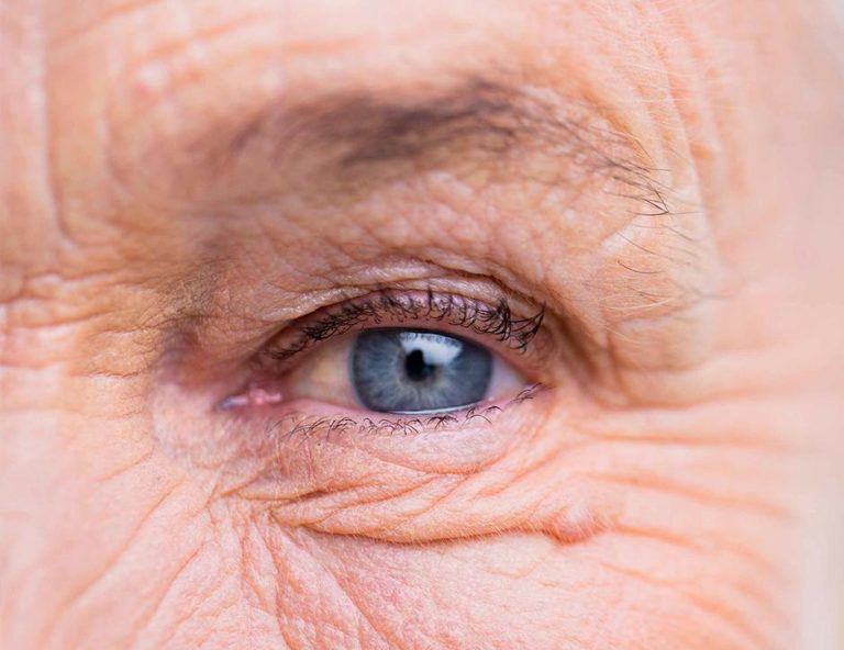 O que é uma lente Multifocal?